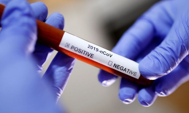 O país já tem 82,53% da população com a 1ª dose e 76,51% dos brasileiros com as duas doses ou com uma dose da vacina da Janssen (Foto: Reuters/Divulgação)