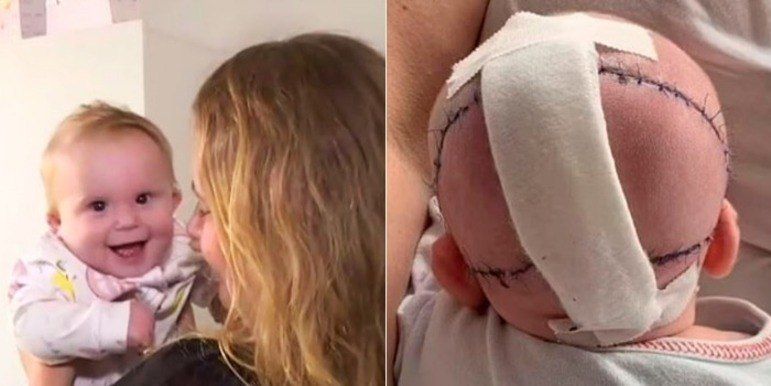 bebe-cranio-1508202214402924_20220816-135022_1.jpeg
